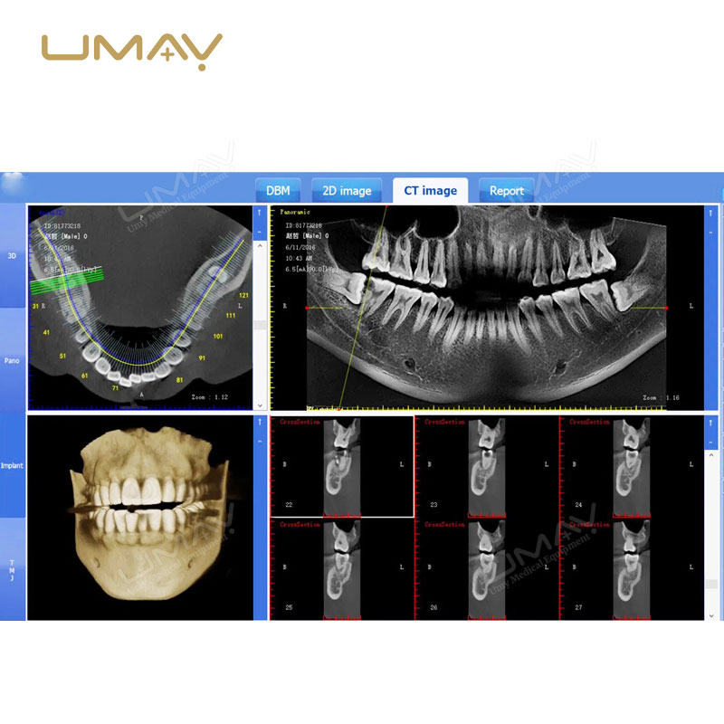 3D CBCT Dental Panoramic X-Ray Machine for Fine-Detail Imaging