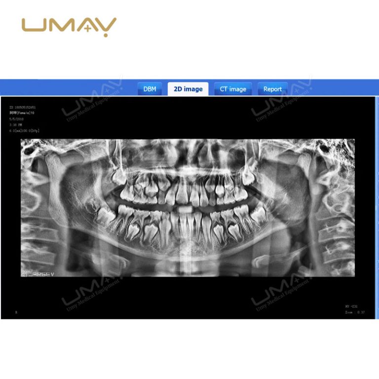 3D CBCT Dental Panoramic X-Ray Machine for Fine-Detail Imaging-3