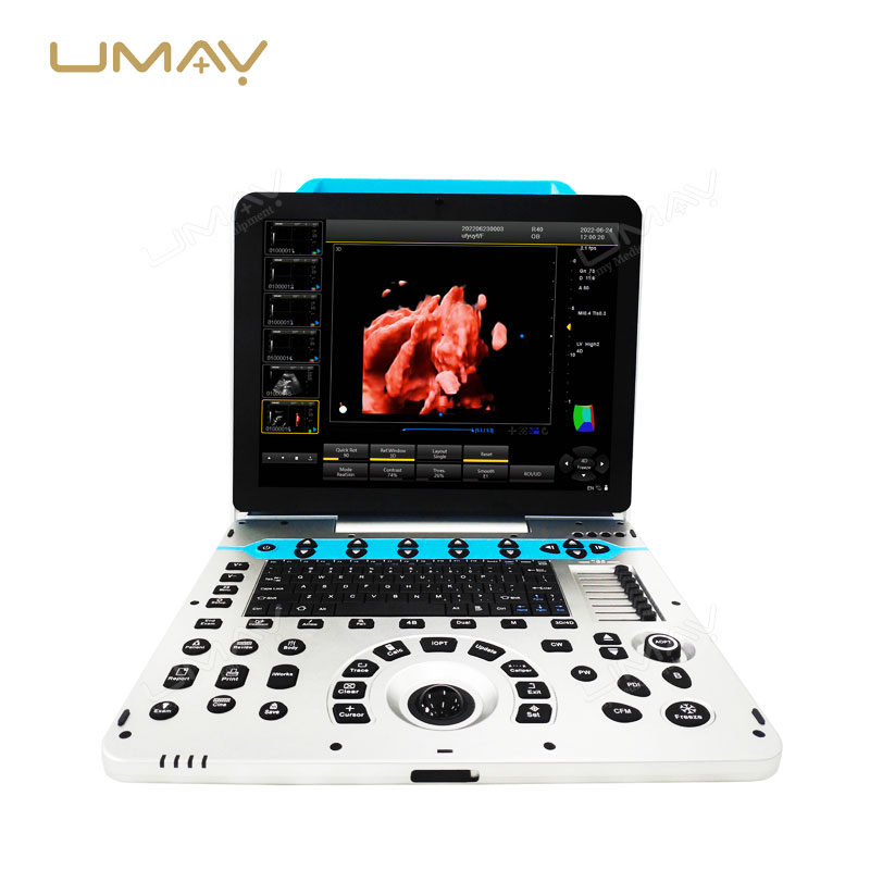 Advanced 4D Color Doppler Ultrasonic Diagnostic System for Medical Imaging