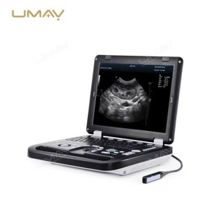 Color Doppler Laptop Ultrasound Machine with Superior Image Quality-1