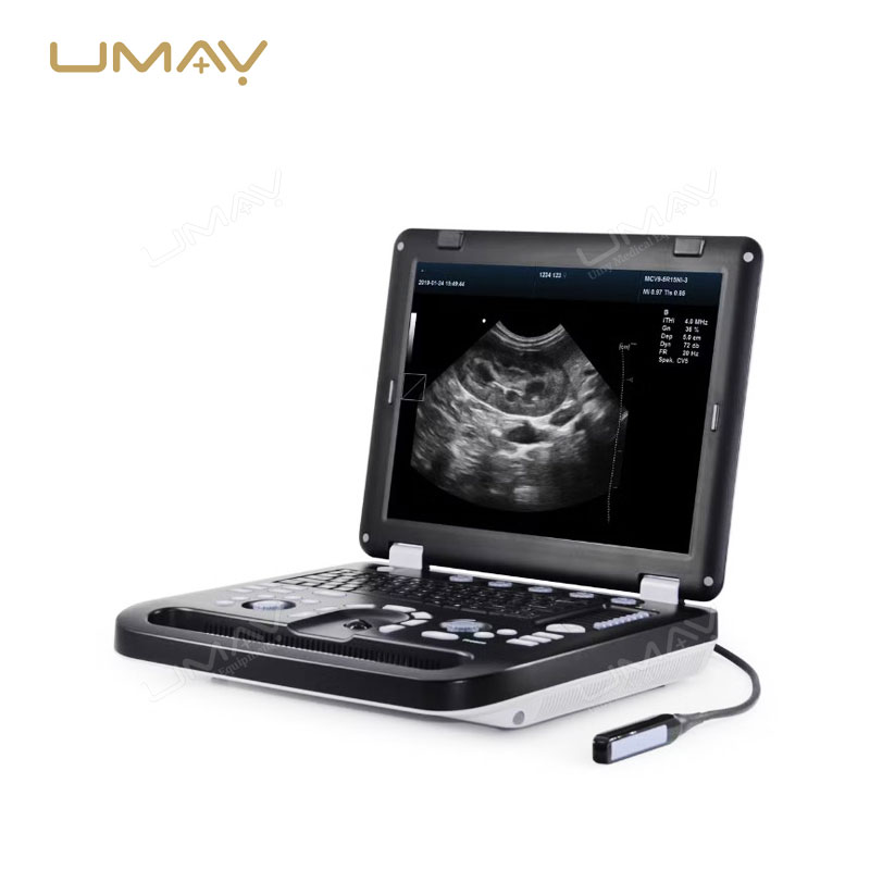 Color Doppler Laptop Ultrasound Machine with Superior Image Quality