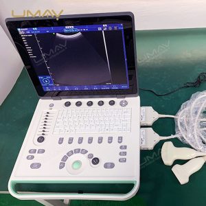 Cost-Effective Color Doppler Ultrasound Machine with High-Quality Imaging-2