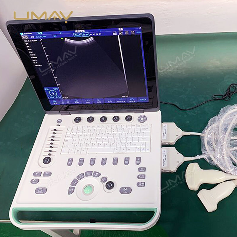 Cost-Effective Color Doppler Ultrasound Machine with High-Quality Imaging