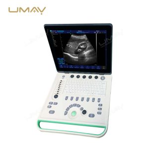 Cost-Effective Color Doppler Ultrasound Machine with High-Quality Imaging-3