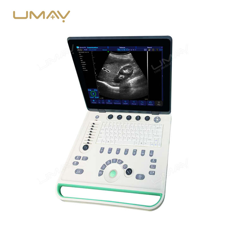 Cost-Effective Color Doppler Ultrasound Machine with High-Quality Imaging