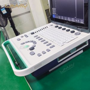 Cost-Effective Color Doppler Ultrasound Machine with High-Quality Imaging-4