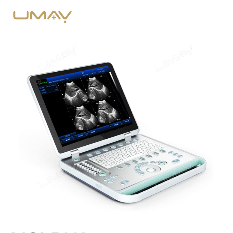 Full Digital Portable Laptop Ultrasound Instrument with Crystal-Clear Imaging