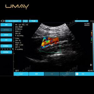 Handheld Micro-Convex Color Doppler Veterinary Ultrasound Probe with IPX7 Waterproof Design-4