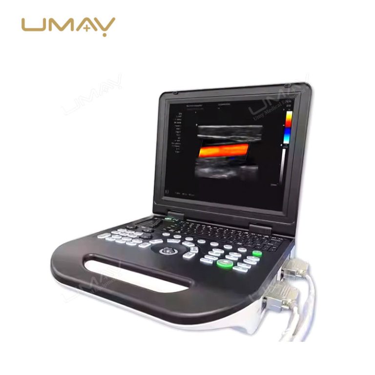 High-Quality Portable 3D Color Doppler Ultrasound Machine for Hospitals at Factory Price