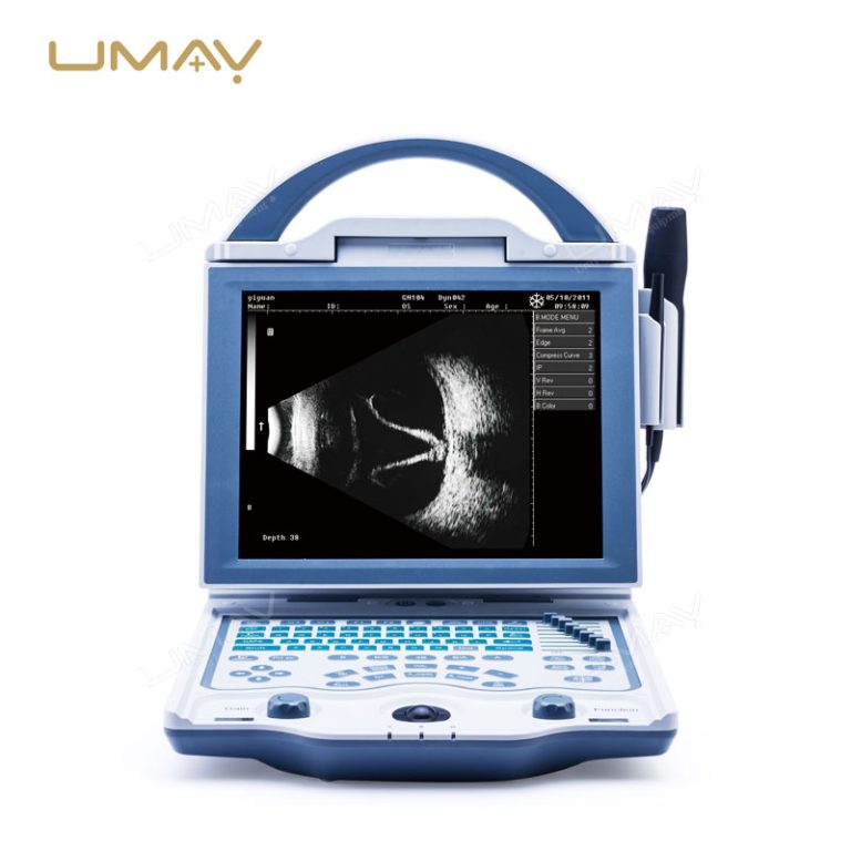 Popular Model High-Frequency Ophthalmic Ultrasound A B Scan-6