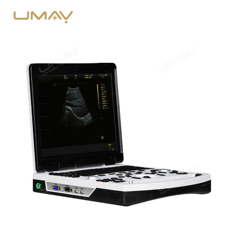 Portable 12.1-Inch LED Black and White Ultrasound Machine with Multiple Imaging Modes