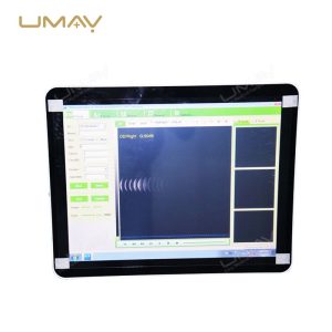 Portable 15-Inch Ophthalmic A B Ultrasound Scanner for Eye Disease Diagnosis-3