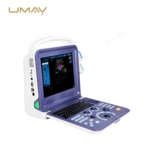 Portable 3D 4D Color Doppler Ultrasound Scanner for Obstetrics, Cardiology, and Abdominal Diagnostics-2