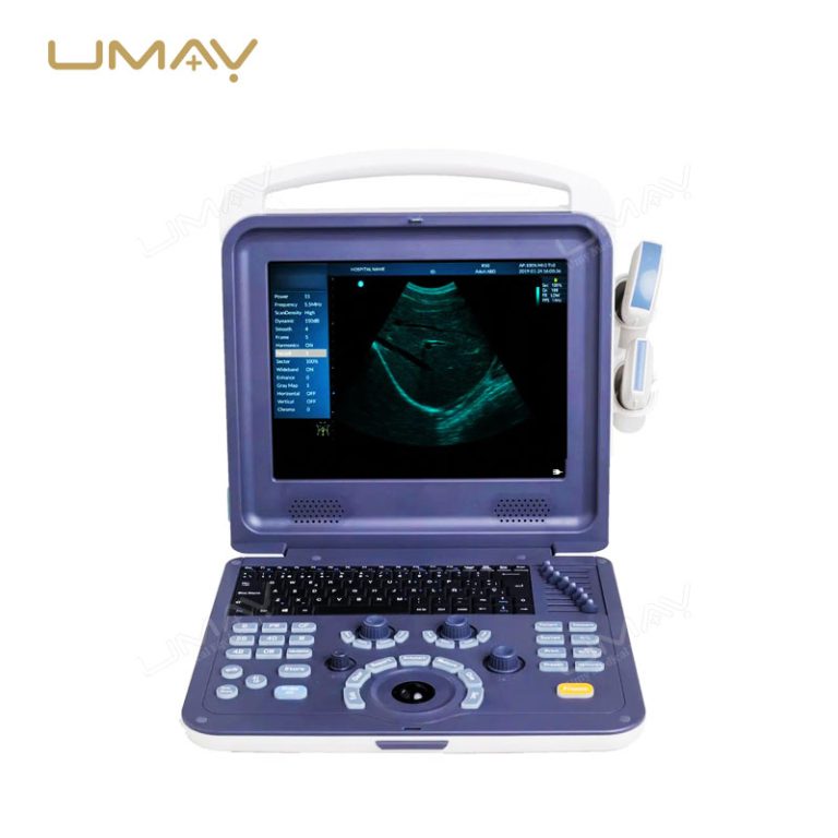 Portable 3D 4D Color Doppler Ultrasound Scanner for Obstetrics, Cardiology, and Abdominal Diagnostics-3