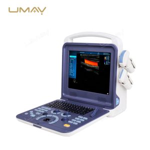 Portable 3D 4D Color Doppler Ultrasound Scanner for Obstetrics, Cardiology, and Abdominal Diagnostics-4