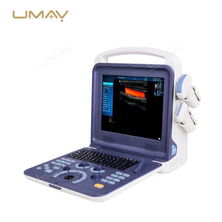 Portable 3D/4D Color Doppler Ultrasound Scanner for Obstetrics, Cardiology, and Abdominal Diagnostics