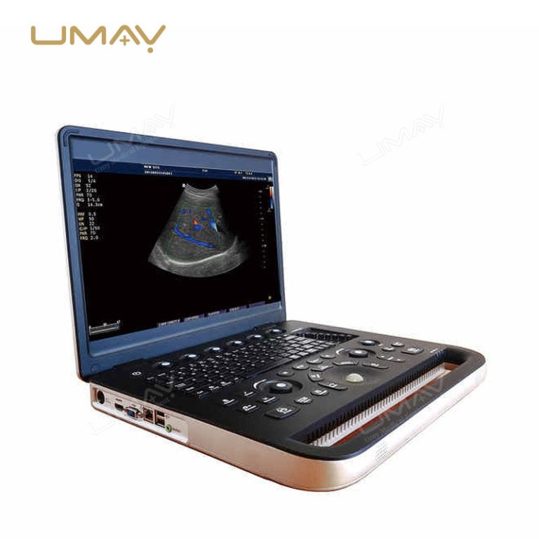 Portable Laptop Color Doppler Ultrasound Machine for Small Hospitals and Community Clinics-3