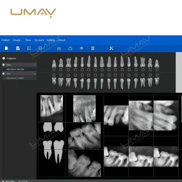 Portable USB Digital Intraoral X-Ray Sensor for Dental Imaging-1