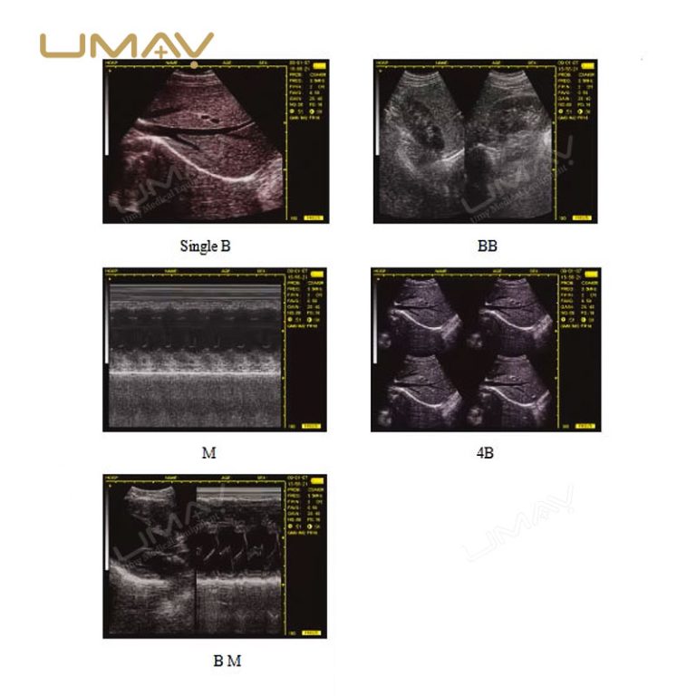 Top Choice for Veterinarians Portable Full Digital B-Mode Veterinary Ultrasound Scanner-1