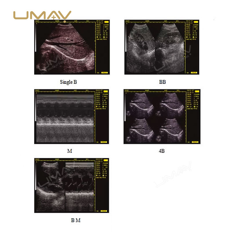 Top Choice for Veterinarians: Portable Full Digital B-Mode Veterinary Ultrasound Scanner