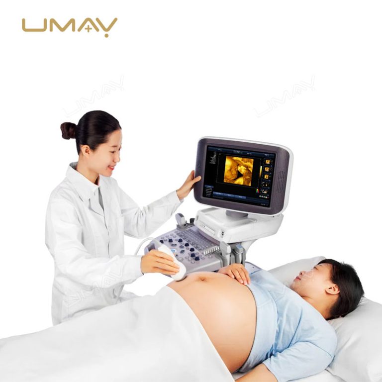 Trolley-Based Digital Diagnostic Ultrasound System with Color Doppler-5