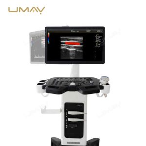 Trolley Color Doppler Ultrasound Machine with 21