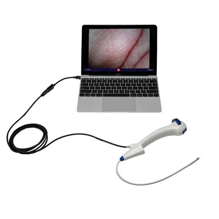 Portable Touch Screen Endoscope with Disposable Flexible Bronchoscope and Ureteroscope Compatibility