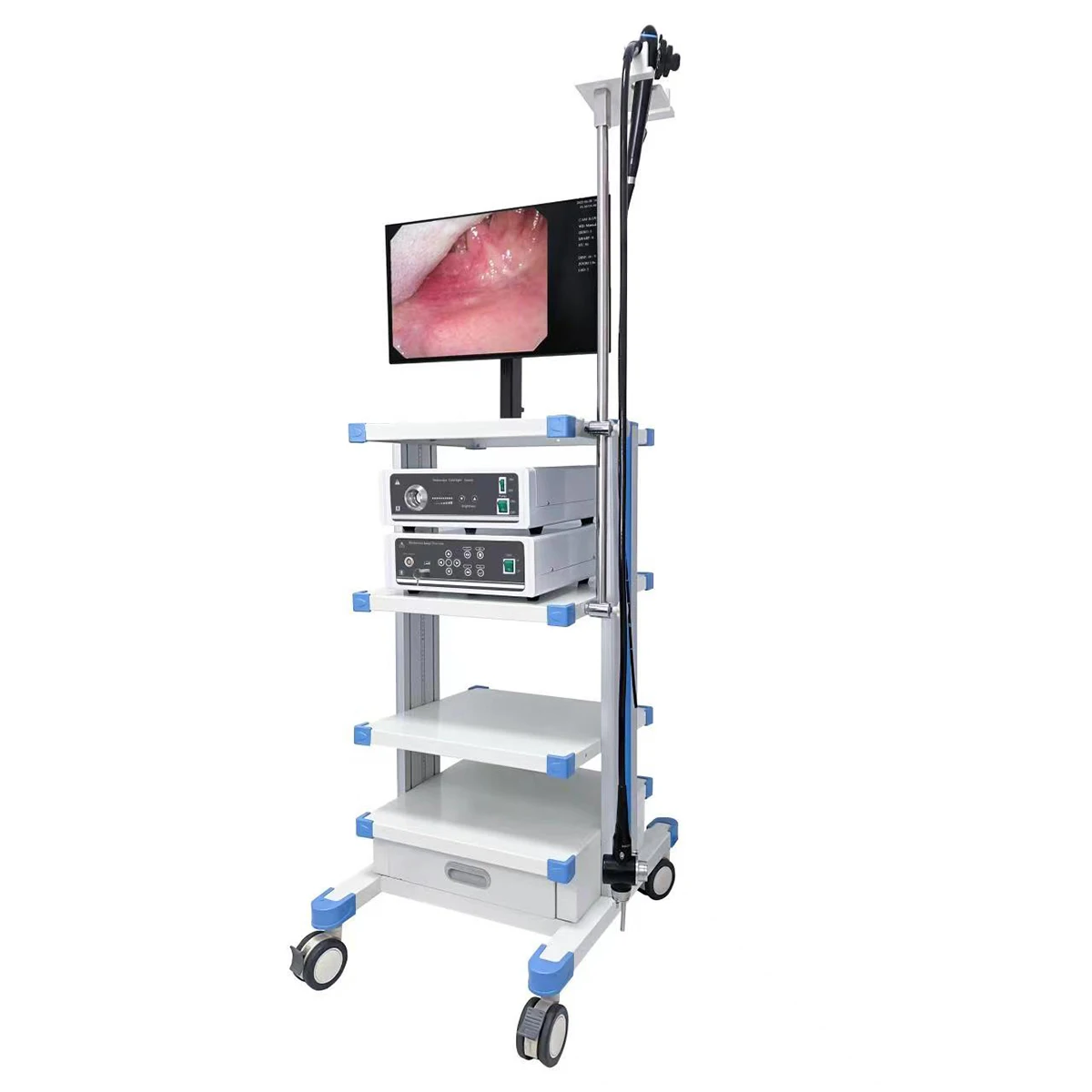 Cost-Effective Medical Video Gastroscope and Colonoscope