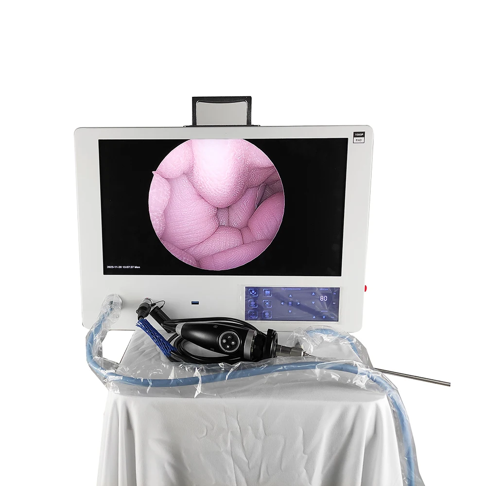 All-in-One Full HD Endoscopy System with Touch Screen