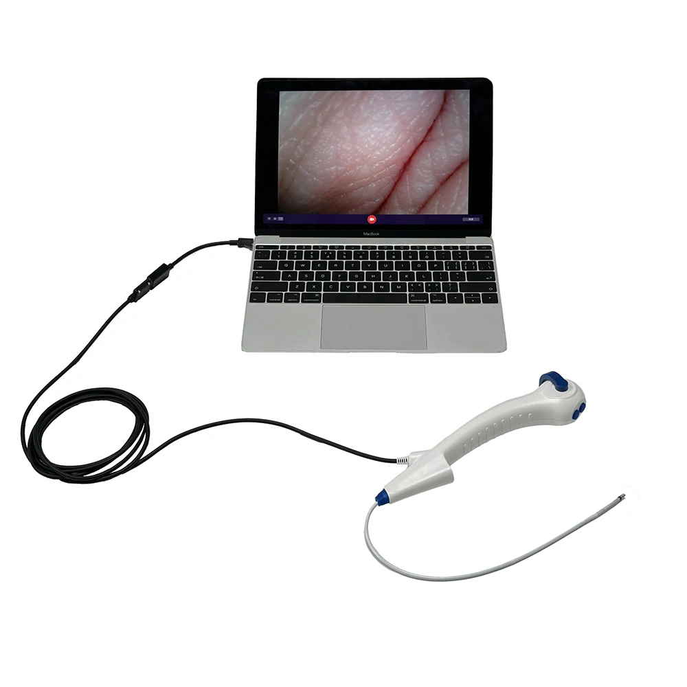 Portable Disposable Flexible Video Ureteroscope with 10-Inch Touch Screen