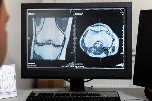 Doctor looking at CT scans on computer