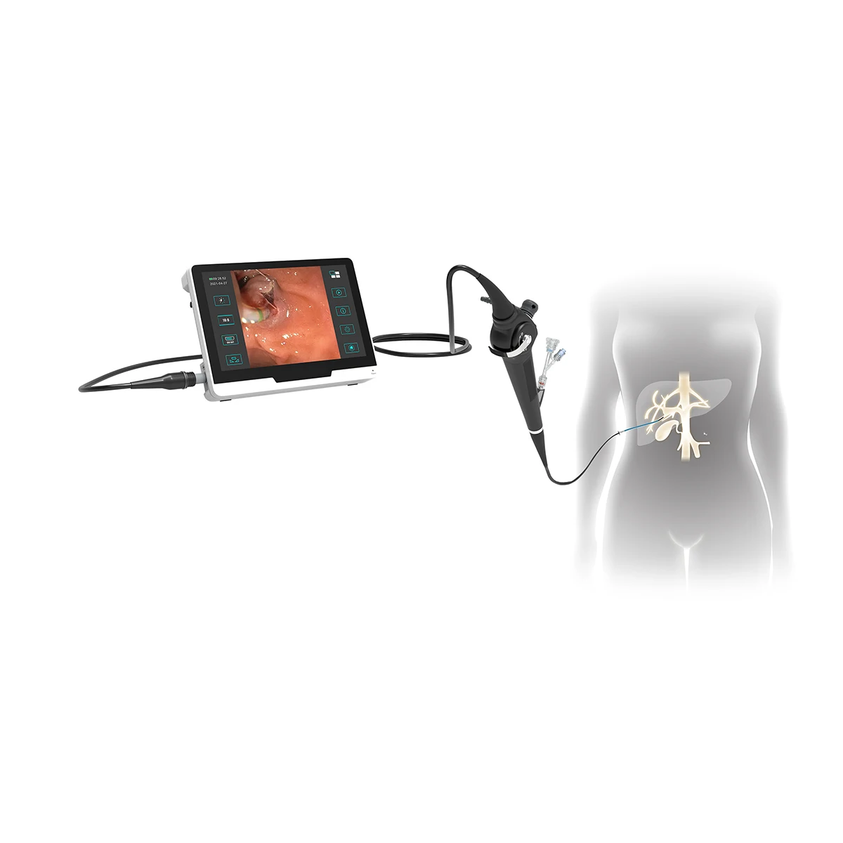 Choledochoscope Video Endoscope Camera for Surgical Use