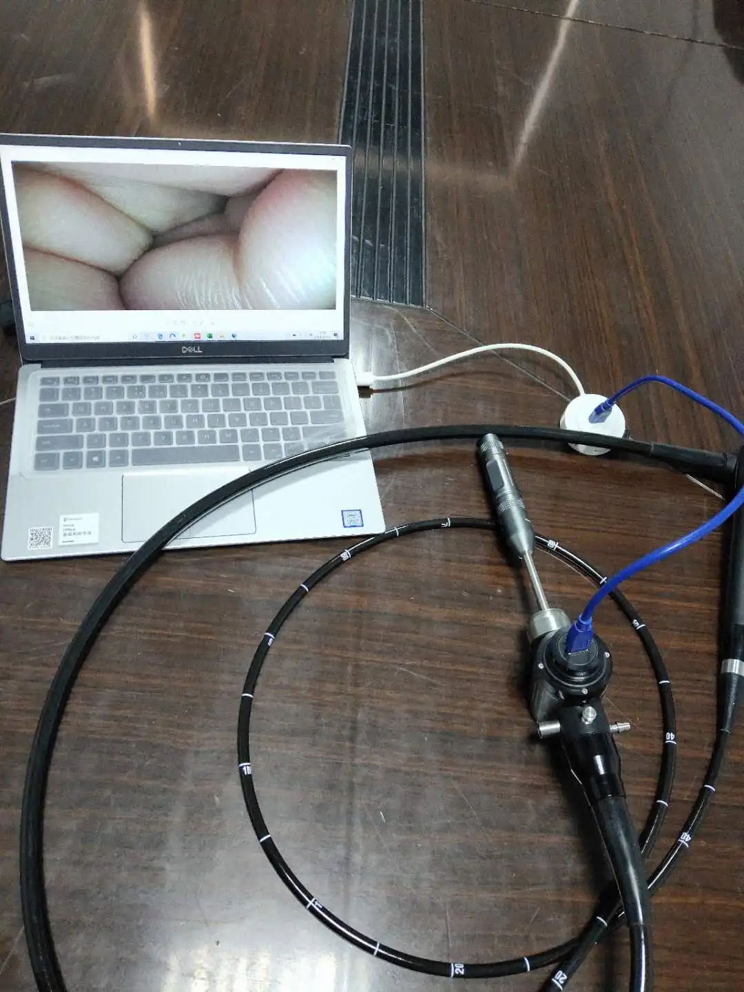 High-Quality Portable Veterinary Flexible Endoscope and Gastroscope for Dogs