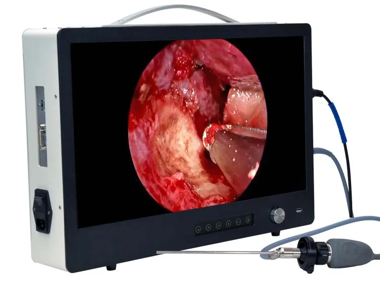 Full HD Surgical Endoscope Camera with 80W LED Cold Light Source