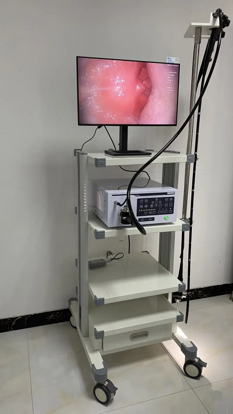 HD 1080P Multifunctional Video Bronchoscope, Nasopharyngoscope, Cystoscope, and Ureteroscope for Comprehensive Human Diagnostics