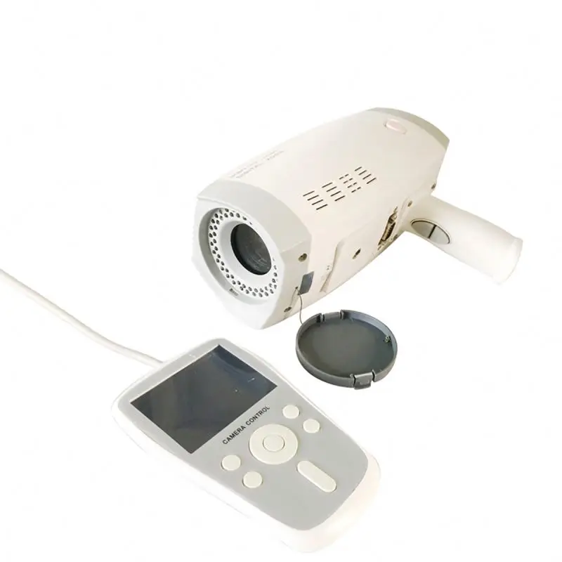 In-Demand Portable Digital Video Colposcope for Gynecological Examinations