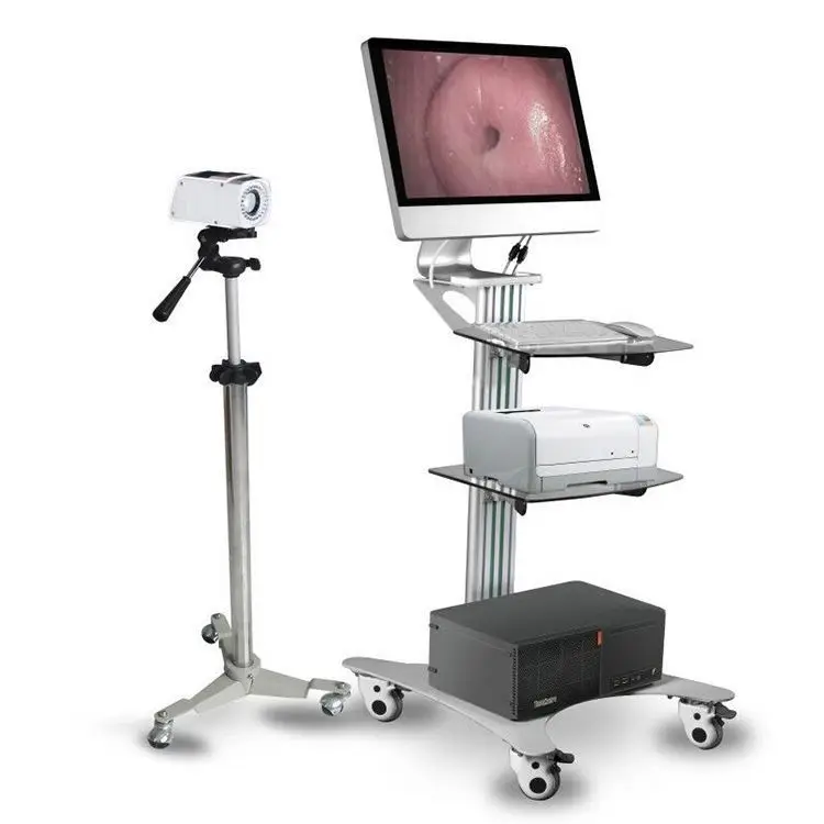 Video Colposcope Camera Machine for Gynecological Examination and Cervical Screening