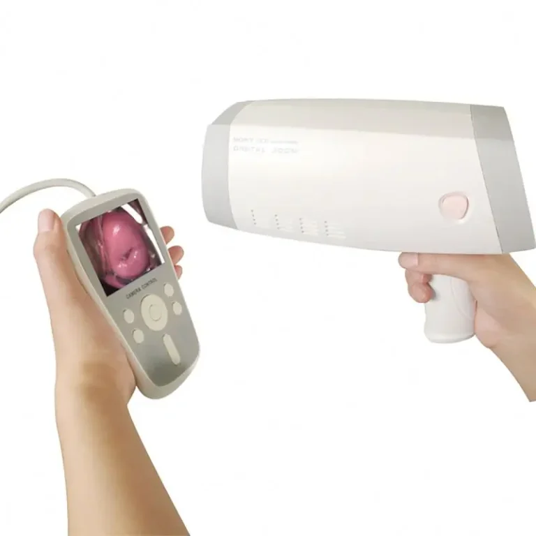 In-Demand Portable Digital Video Colposcope for Gynecological Examinations