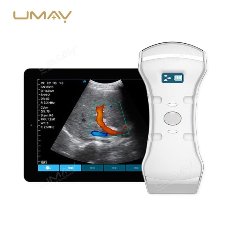 Handheld Color Doppler Ultrasound Machine with 3-in-1 Probes for Elite Image Definition-4