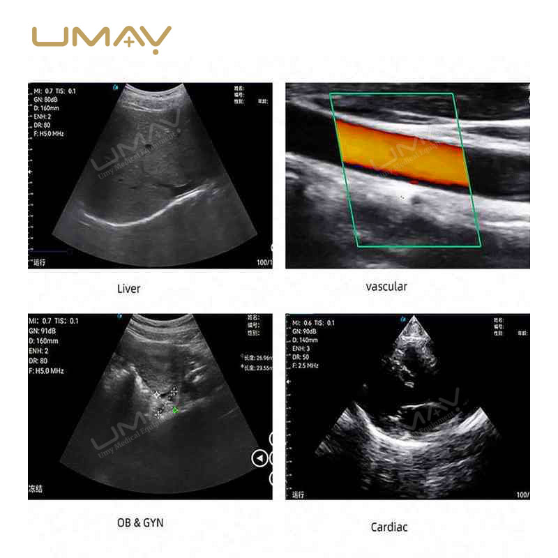 Handheld Color Doppler Ultrasound Machine with 3-in-1 Probes for Elite Image Definition