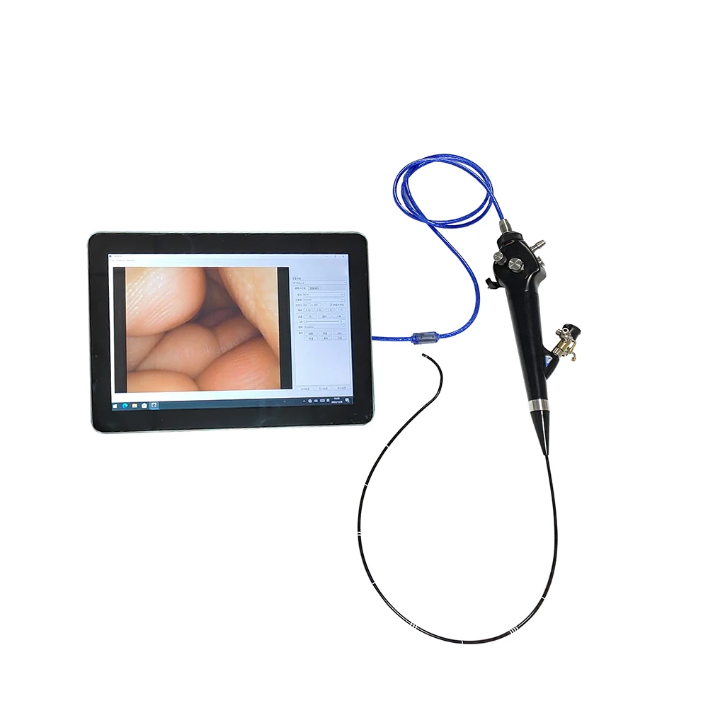 Multi-Function Portable Flexible Endoscope System with 10-Inch Touch Pad