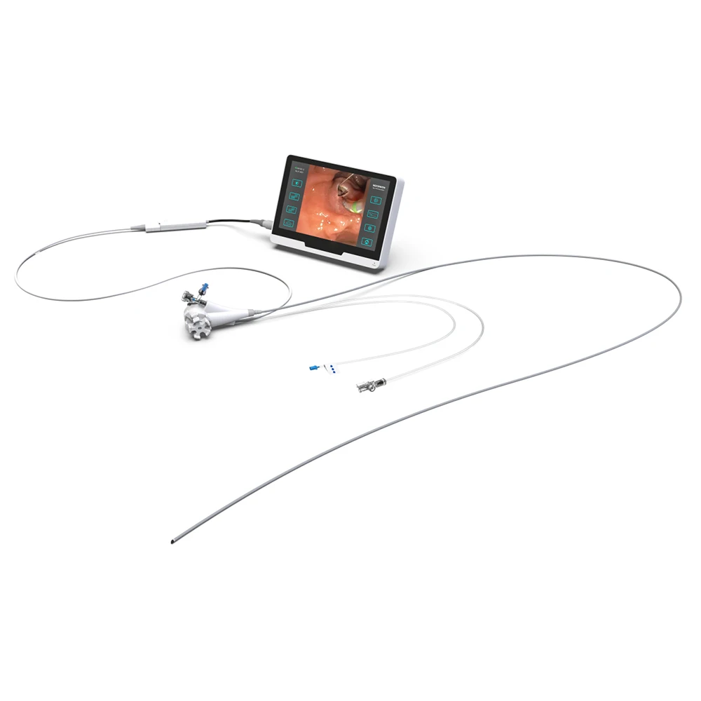 Disposable Video Choledochoscope with Integrated Image Processor for High-Resolution Detail