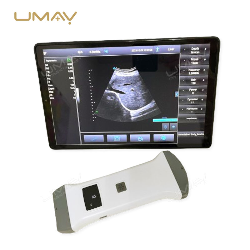 Portable Color Doppler Ultrasound Machine with 24 Channels for High-Precision Imaging