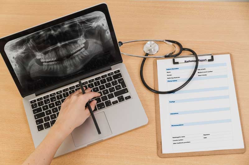 Radiography-on-laptop-with-report-sample-umymedical