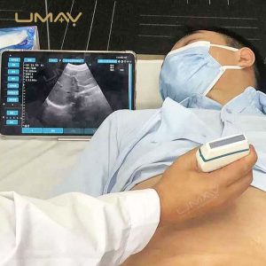 Wireless Color Doppler Ultrasound with AI Teaching for Emergency and Small Venue Applications-5