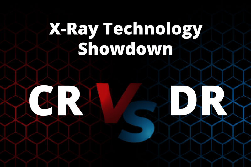 Comparison of Computed Radiography (CR) and Digital Radiography (DR) in X-ray imaging technology, highlighting their differences in efficiency and quality