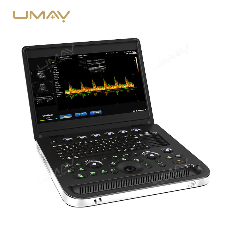 Ultra-thin B W ultrasound machine with real-time spatial compound imaging