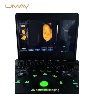 Ultra-thin B W ultrasound machine with real-time spatial compound imaging-3