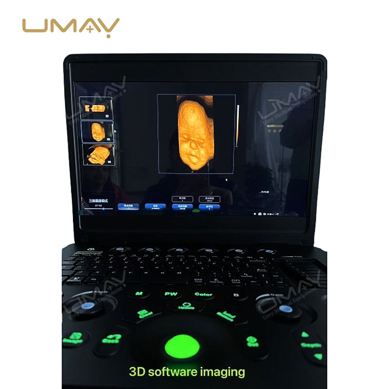 Ultra-thin B W ultrasound machine with real-time spatial compound imaging