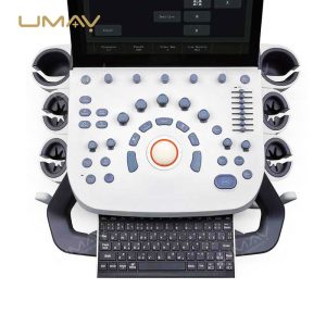 Budget-Wise Option P9 Color Doppler Ultrasound Machine for Clinic-1